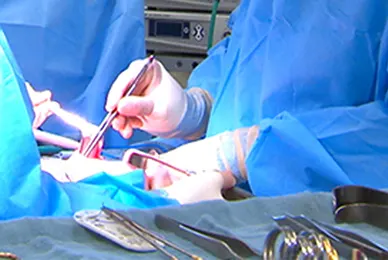 Surgical Procedure Video